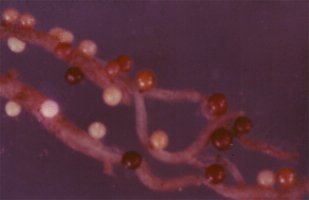 Cysten van het aardappelcystenaaltje (Globodera rostochiensis) op aardappelwortels. Foto copyright Laboratorium voor Fytopathologie, Wageningen Universiteit.